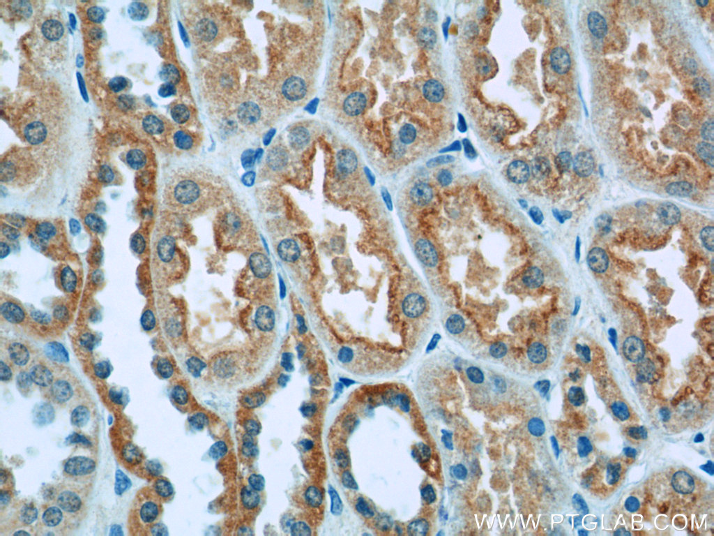 14274-1-AP;human kidney tissue