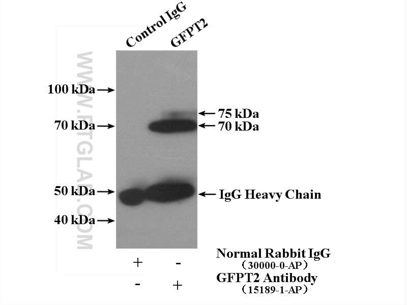 15189-1-AP;HT-1080 cells