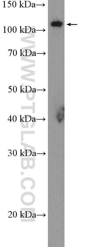 20713-1-AP;pig lung tissue