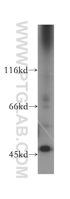 11068-1-AP;Jurkat cell