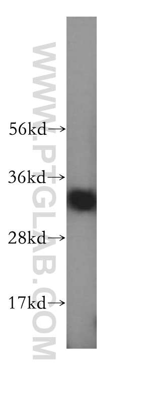 17293-1-AP;Jurkat cell