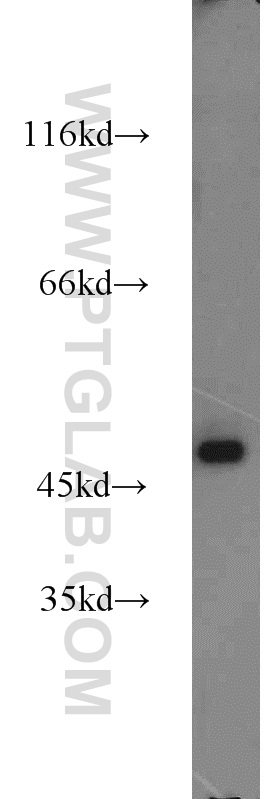 15428-1-AP;HeLa cells