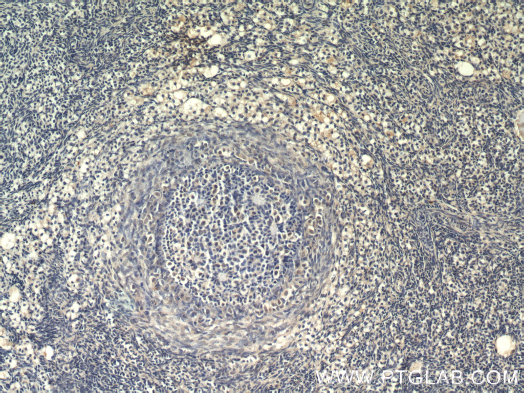 55292-1-AP;human ovary tissue