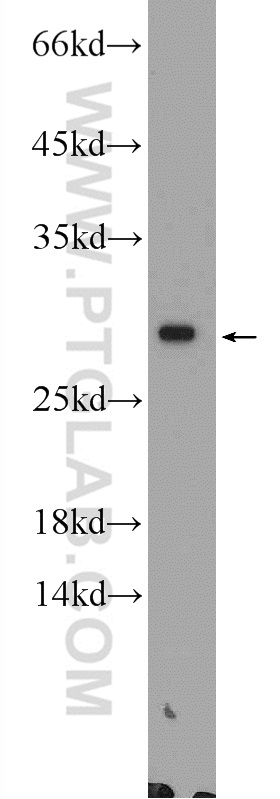 55292-1-AP;mouse ovary tissue