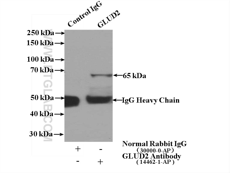 14462-1-AP;mouse liver tissue