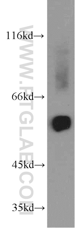 15575-1-AP;human heart tissue