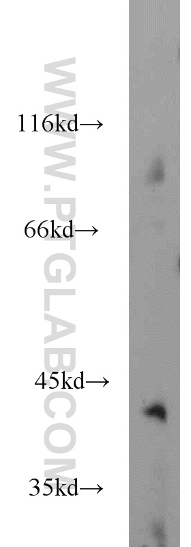 15094-1-AP;mouse brain tissue