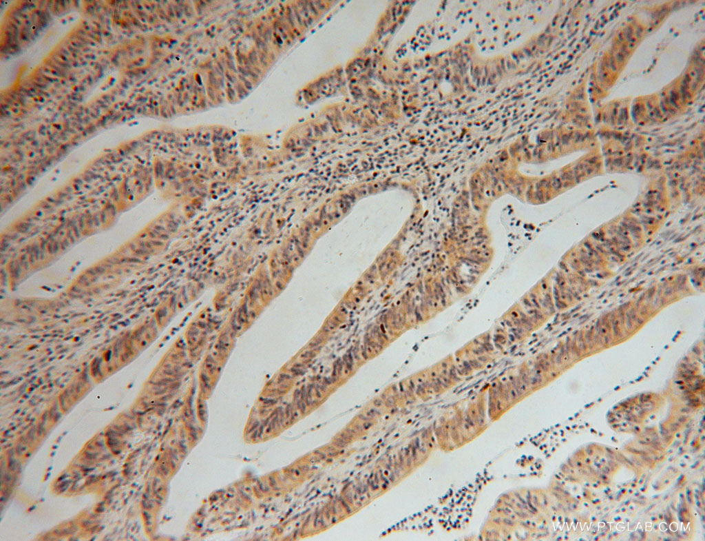 gmpr-1-2-antibody-15683-1-ap-proteintech