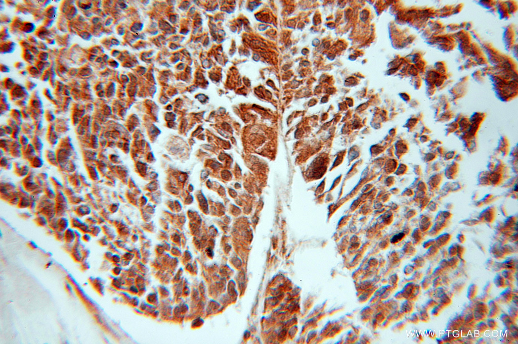 11045-2-AP;human ovary tumor