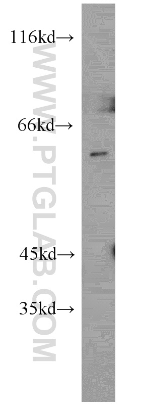 15060-1-AP;K-562 cell