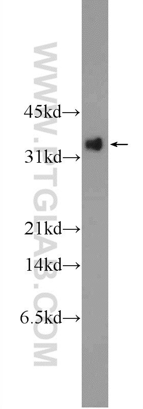 24494-1-AP;Recombinant protein