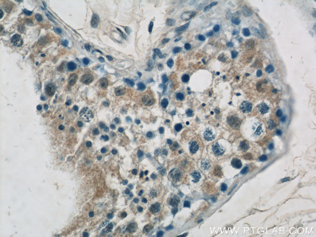 24366-1-AP;human testis tissue