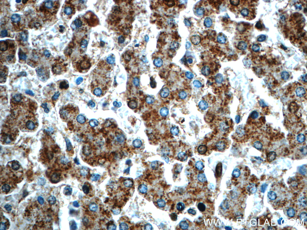 24399-1-AP;human liver tissue