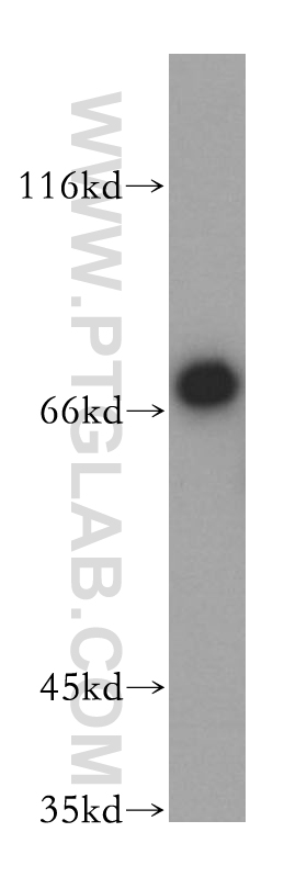 17219-1-AP;mouse skeletal muscle tissue