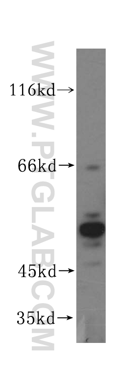 14728-1-AP;HeLa cell