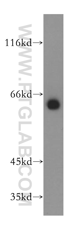 17950-1-AP;mouse liver tissue