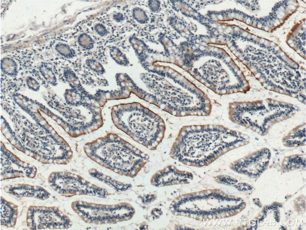 23326-1-AP;human small intestine tissue