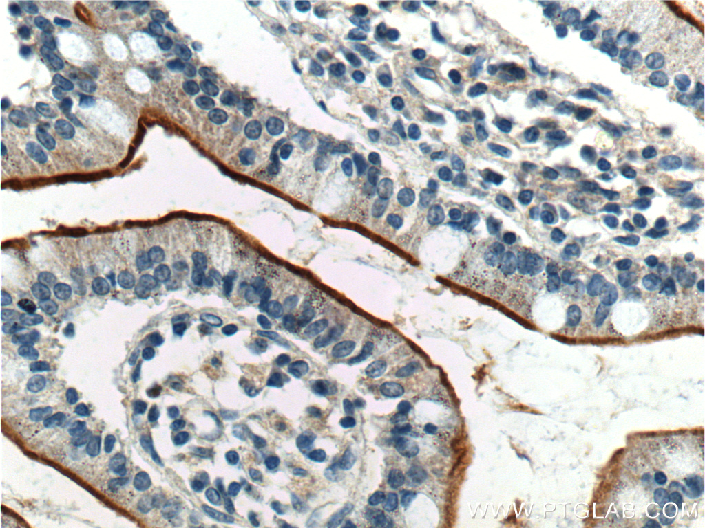 23326-1-AP;human small intestine tissue