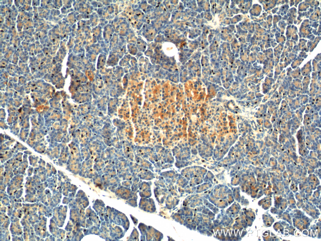 20146-1-AP;human pancreas tissue