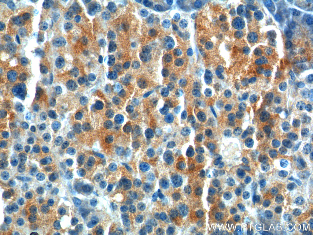 20146-1-AP;human pancreas tissue