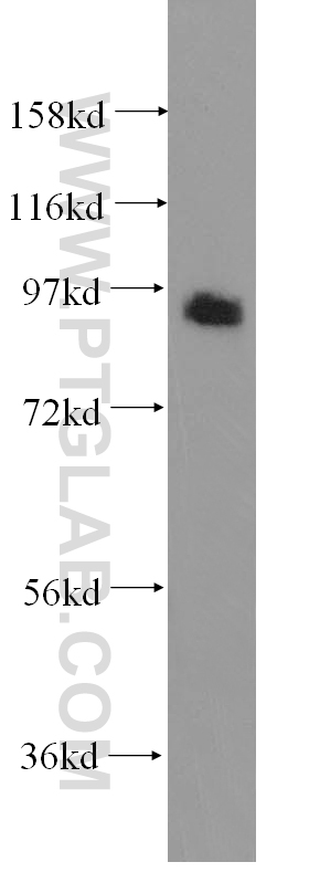 12159-1-AP;HEK-293 cell