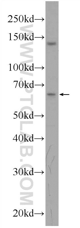 24299-1-AP;PC-3 cells