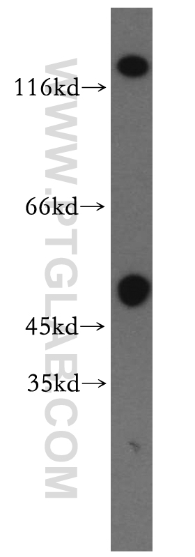 13597-1-AP;human brain tissue