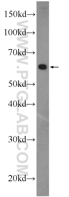 25823-1-AP;MDA-MB-453s cells