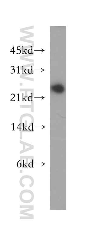 12720-1-AP;MCF7 cells