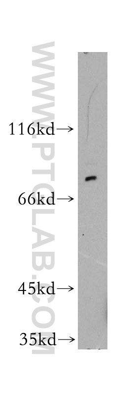 10763-1-AP;SGC-7901 cell