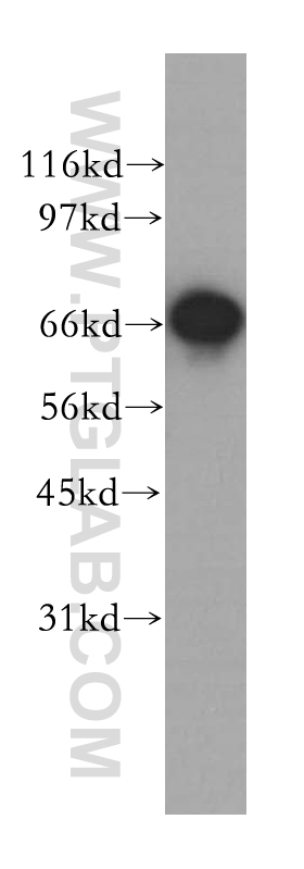 12989-1-AP;MCF7 cells