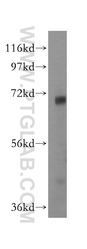 17502-1-AP;mouse liver tissue