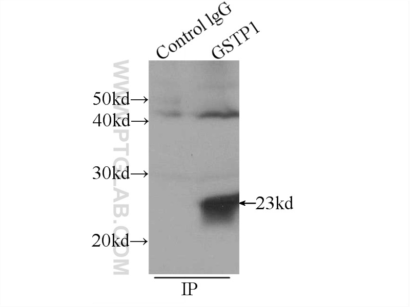 15902-1-AP;mouse brain tissue