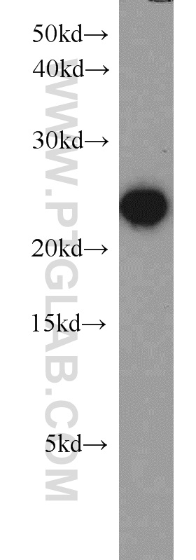 15902-1-AP;Jurkat cells