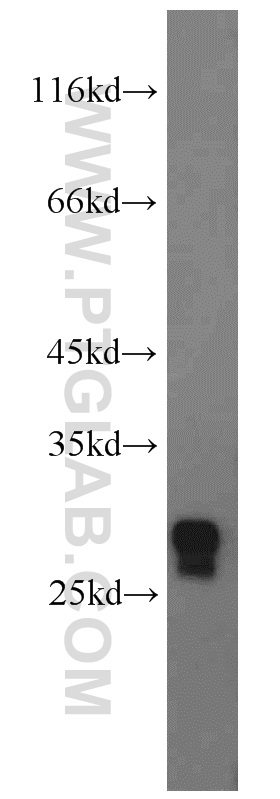 14889-1-AP;mouse liver tissue