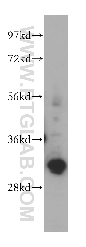 15139-1-AP;K-562 cell