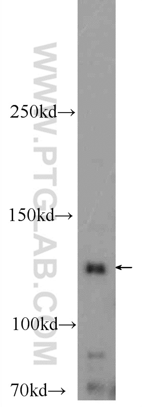 25252-1-AP;mouse heart tissue