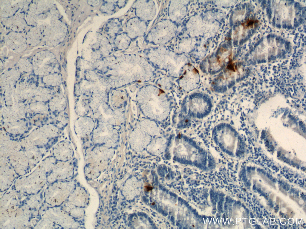 Gastrin Antibody 60346 1 Ig Proteintech