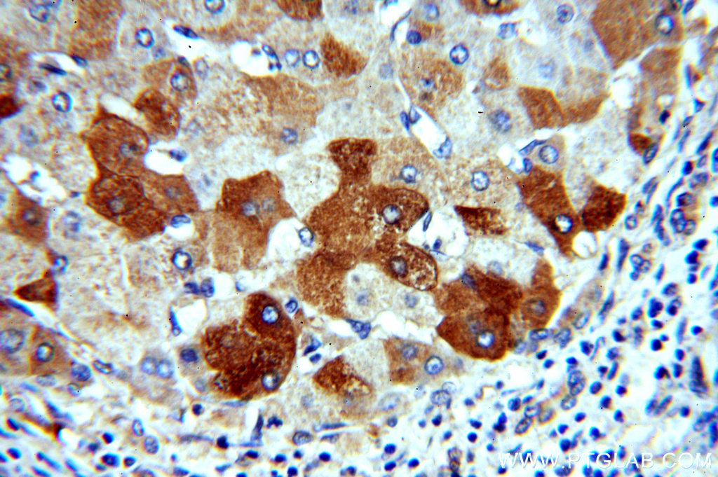 15255-1-AP;human hepatocirrhosis