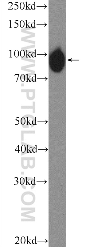 15255-1-AP;HepG2 cells