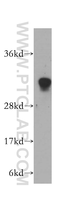 15118-1-AP;human heart tissue