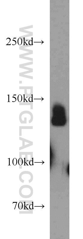 55224-1-AP;mouse brain tissue