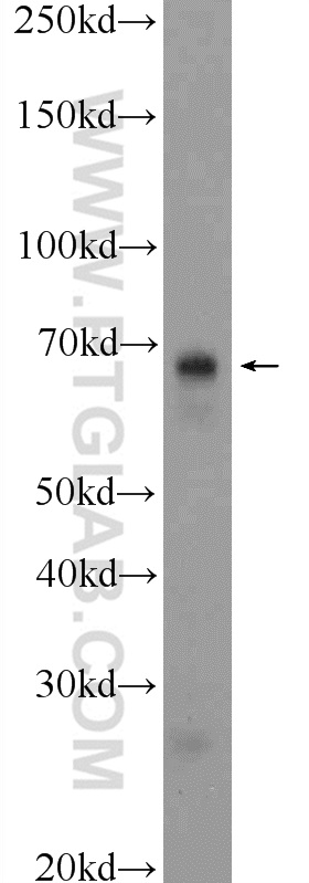 24913-1-AP;fetal human brain tissue