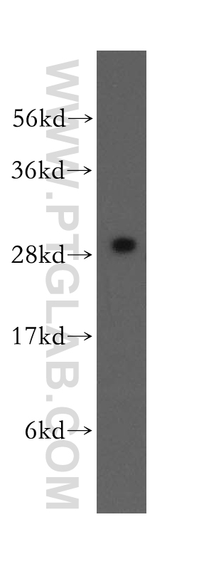 12380-1-AP;human brain tissue