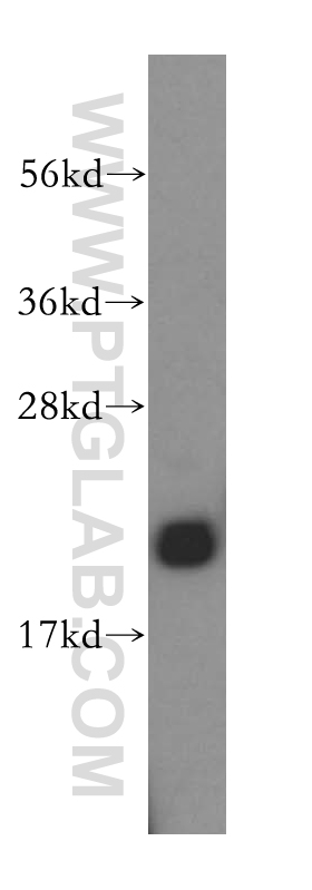 16842-1-AP;mouse liver tissue