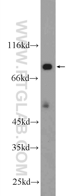 25351-1-AP;mouse brain tissue