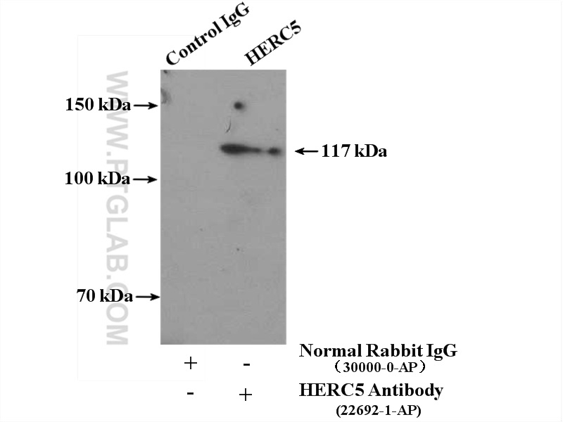 22692-1-AP;HEK-293 cells