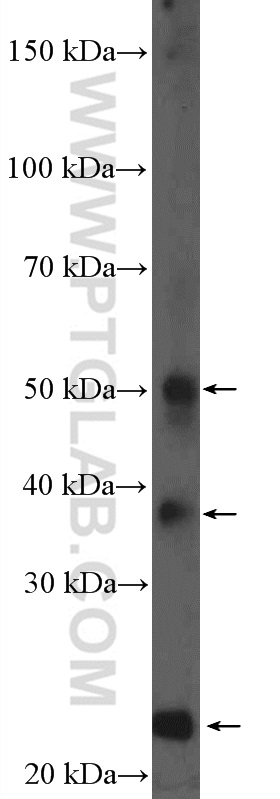 11758-1-AP;mouse liver tissue