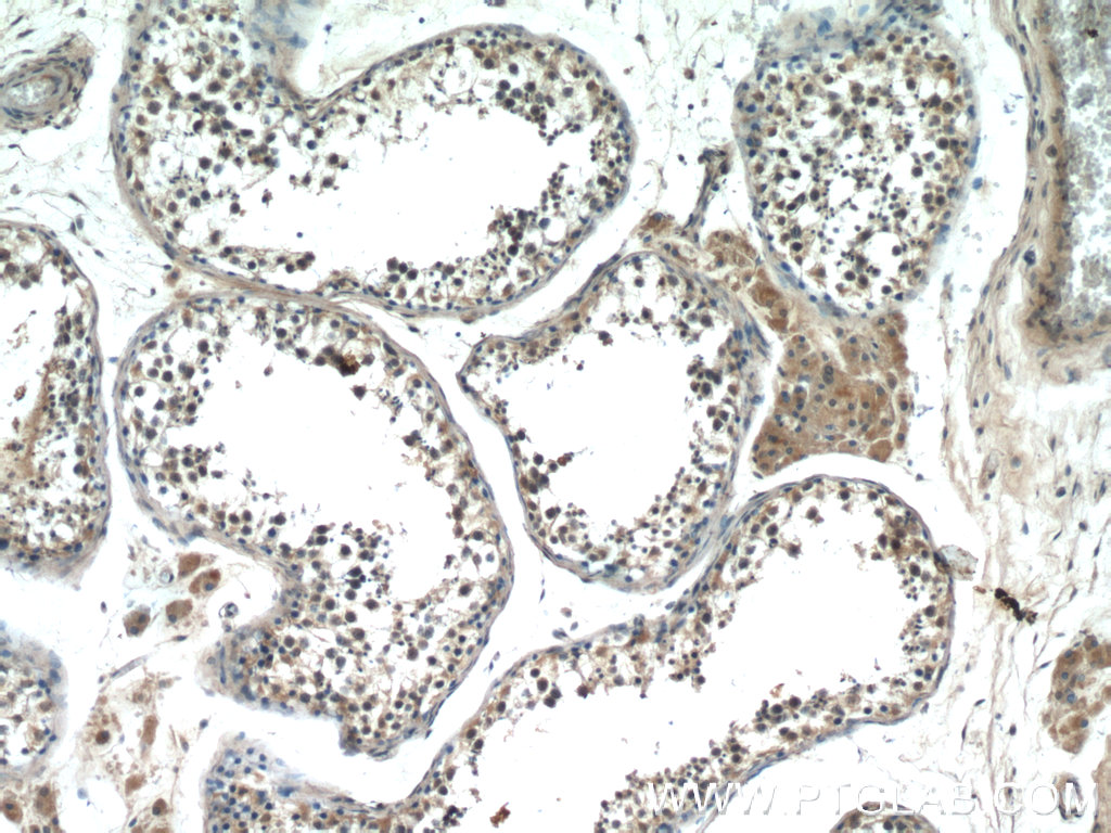 Hivep1 Antibody 25168 1 Ap Proteintech