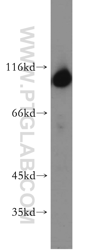 19662-1-AP;human brain tissue